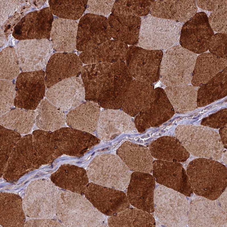 ST3GAL6 Antibody - BSA Free Immunohistochemistry: ST3GAL6 Antibody - BSA Free [NBP1-92446]