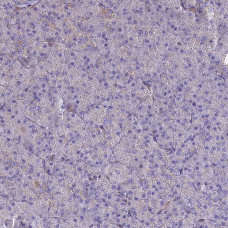 ST3GAL6 Antibody - BSA Free Immunohistochemistry: ST3GAL6 Antibody - BSA Free [NBP1-92446]