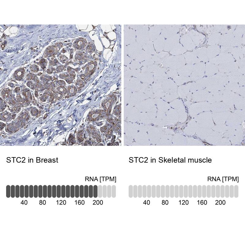 Stanniocalcin 2/STC-2 Antibody - BSA Free Immunohistochemistry: Stanniocalcin 2/STC-2 Antibody - BSA Free [NBP1-92447]