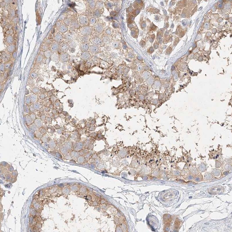 STK11IP Antibody - BSA Free Immunohistochemistry: STK11IP Antibody - BSA Free [NBP1-92451]