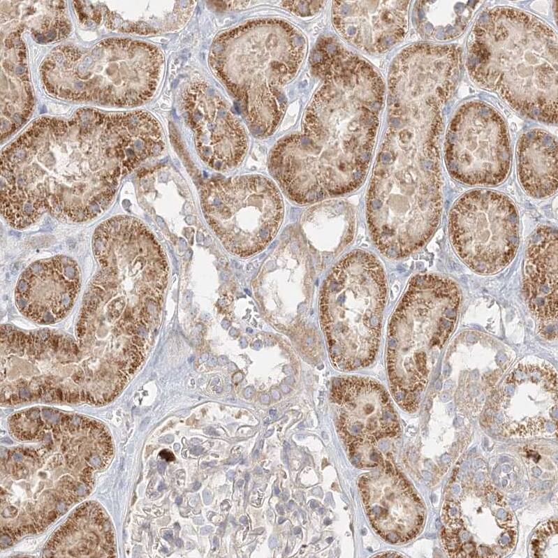 STK11IP Antibody - BSA Free Immunohistochemistry: STK11IP Antibody - BSA Free [NBP1-92451]