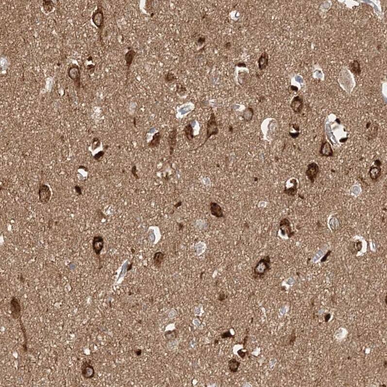 STK11IP Antibody - BSA Free Immunohistochemistry: STK11IP Antibody - BSA Free [NBP1-92451]