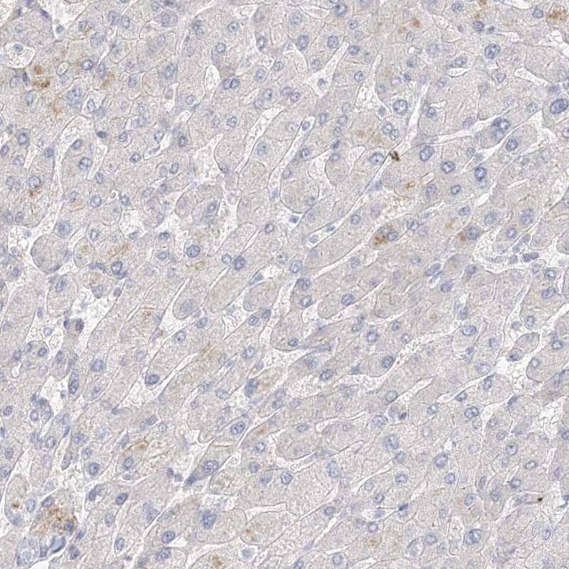 STK11IP Antibody - BSA Free Immunohistochemistry: STK11IP Antibody - BSA Free [NBP1-92451]