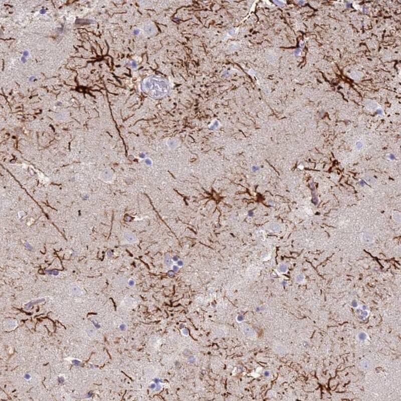 STK25 Antibody - BSA Free Immunohistochemistry: STK25 Antibody - BSA Free [NBP1-92453]