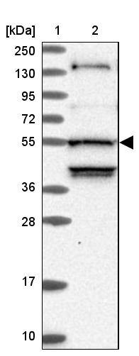 STK38L Antibody - BSA Free Western Blot: STK38L Antibody - BSA Free [NBP1-92454]