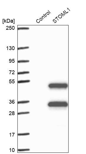 Stomatin-like protein 1 Antibody - BSA Free Western Blot: Stomatin-like protein 1 Antibody - BSA Free [NBP1-92455]
