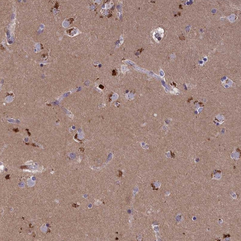 STYX Antibody - BSA Free Immunohistochemistry-Paraffin: STYX Antibody [NBP1-92457]