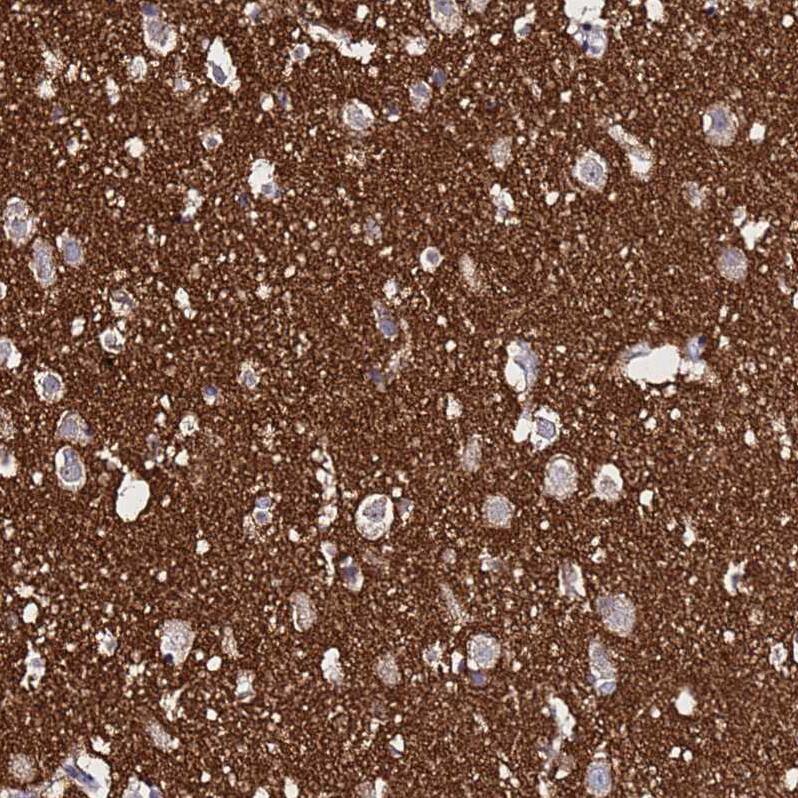SV2B Antibody - BSA Free Immunohistochemistry: SV2B Antibody - BSA Free [NBP1-92462]