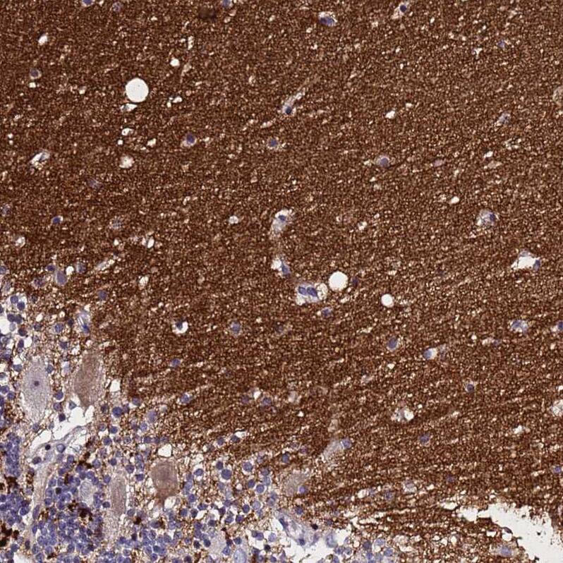 SV2B Antibody - BSA Free Immunohistochemistry: SV2B Antibody - BSA Free [NBP1-92462]