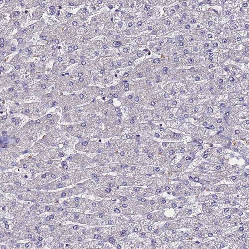 SV2B Antibody - BSA Free Immunohistochemistry: SV2B Antibody - BSA Free [NBP1-92462]
