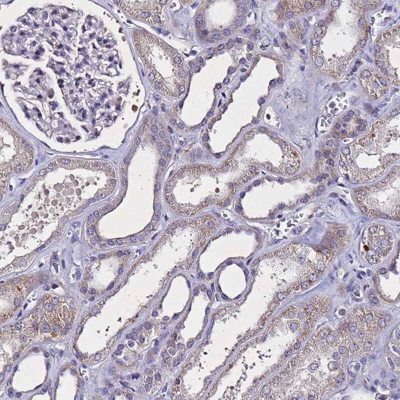 SV2B Antibody - BSA Free Immunohistochemistry: SV2B Antibody - BSA Free [NBP1-92462]