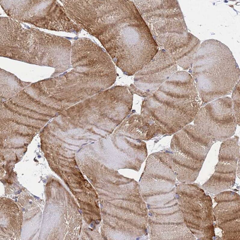 Synaptotagmin 13 Antibody - BSA Free Immunohistochemistry: Synaptotagmin 13 Antibody - BSA Free [NBP1-92466]