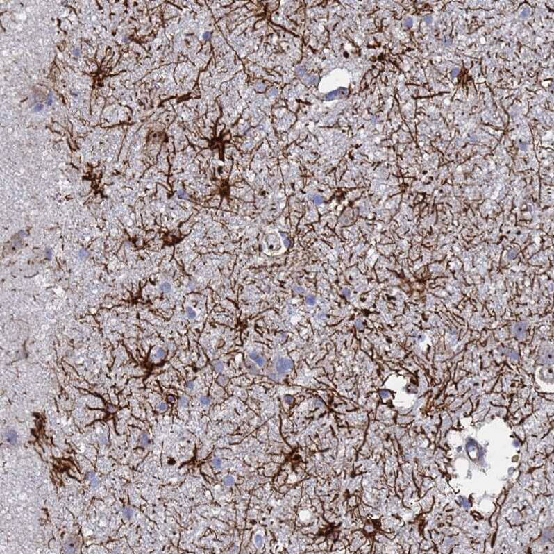 Synaptotagmin 13 Antibody - BSA Free Immunohistochemistry: Synaptotagmin 13 Antibody - BSA Free [NBP1-92466]