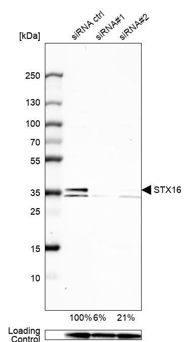 Syntaxin 16 Antibody - BSA Free Western Blot: Syntaxin 16 Antibody - BSA Free [NBP1-92468]