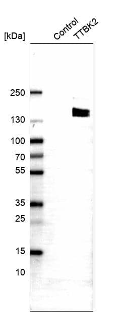 Tau tubulin kinase 2 Antibody - BSA Free Western Blot: Tau tubulin kinase 2 Antibody - BSA Free [NBP1-92476]