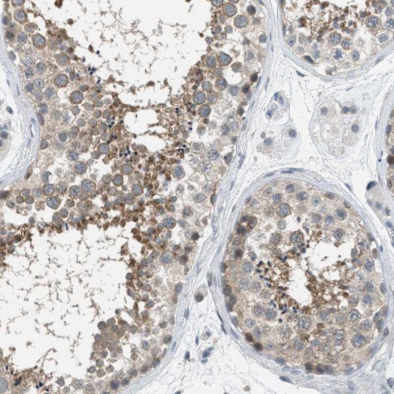 Tau tubulin kinase 2 Antibody - BSA Free Immunohistochemistry: Tau tubulin kinase 2 Antibody - BSA Free [NBP1-92476]
