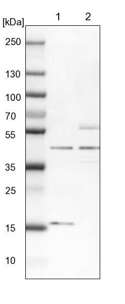 TBC1D13 Antibody - BSA Free Western Blot: TBC1D13 Antibody - BSA Free [NBP1-92477]