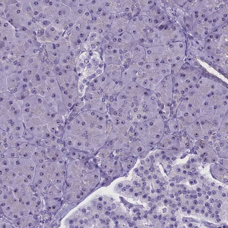 TBL3 Antibody - BSA Free Immunohistochemistry: TBL3 Antibody - BSA Free [NBP1-92481]