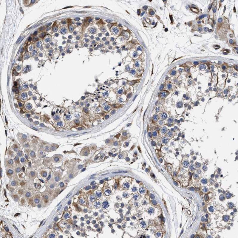 TSPAN33 Antibody - BSA Free Immunohistochemistry: TSPAN33 Antibody - BSA Free [NBP1-92490]