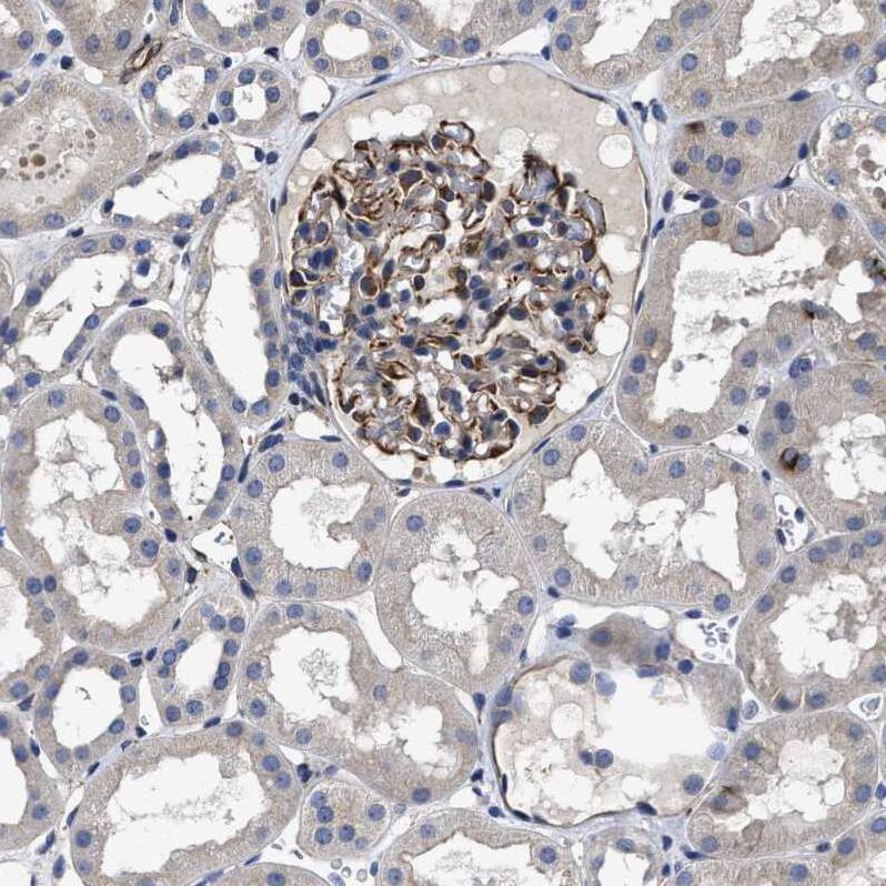 TSPAN33 Antibody - BSA Free Immunohistochemistry: TSPAN33 Antibody - BSA Free [NBP1-92490]