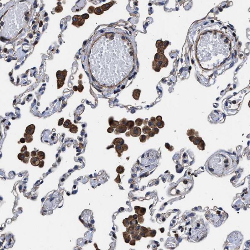 TSPAN33 Antibody - BSA Free Immunohistochemistry: TSPAN33 Antibody - BSA Free [NBP1-92490]