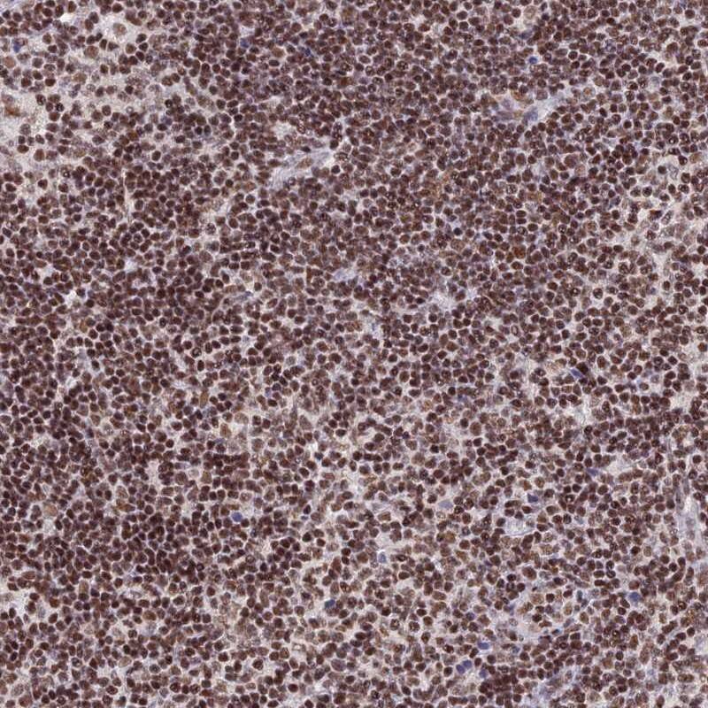 THAP11 Antibody - BSA Free Immunohistochemistry: THAP11 Antibody - BSA Free [NBP1-92495]