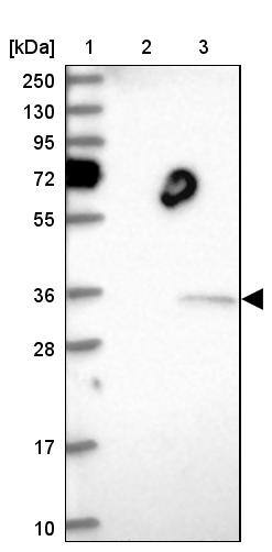 THAP11 Antibody - BSA Free Western Blot: THAP11 Antibody - BSA Free [NBP1-92495]