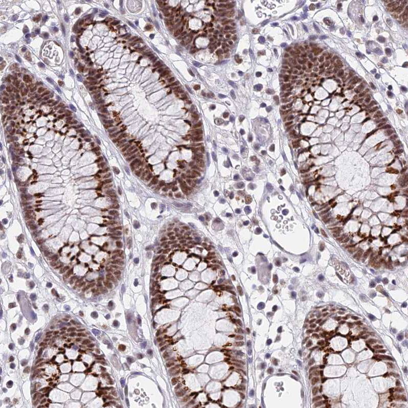 THOC3 Antibody - BSA Free Immunohistochemistry: THOC3 Antibody - BSA Free [NBP1-92502]