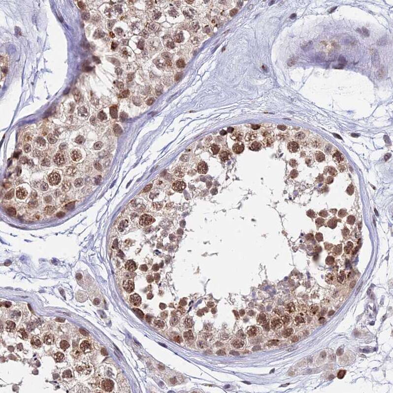 THOC3 Antibody - BSA Free Immunohistochemistry: THOC3 Antibody - BSA Free [NBP1-92502]