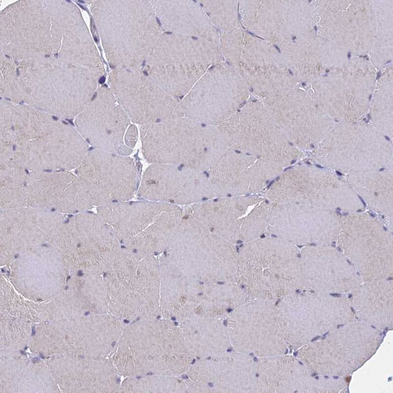 THOC3 Antibody - BSA Free Immunohistochemistry: THOC3 Antibody - BSA Free [NBP1-92502]