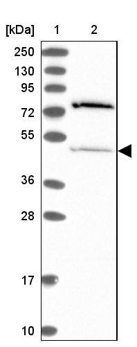 THUMPD2 Antibody - BSA Free Western Blot: THUMPD2 Antibody - BSA Free [NBP1-92504]