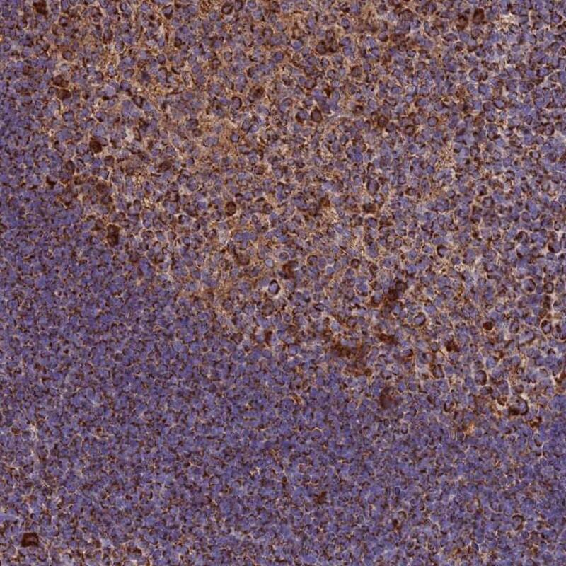 THUMPD2 Antibody - BSA Free Immunohistochemistry: THUMPD2 Antibody - BSA Free [NBP1-92504]