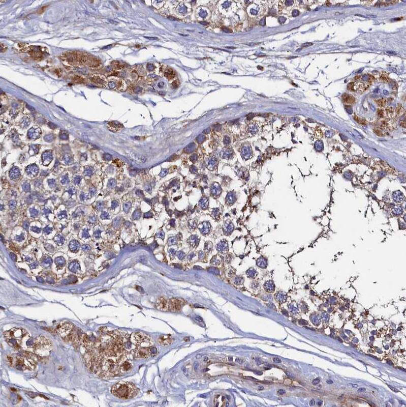 Thymidine Kinase 2 Antibody - BSA Free Immunohistochemistry-Paraffin: Thymidine Kinase 2 Antibody [NBP1-92505]
