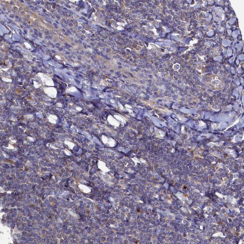 Thymidine Kinase 2 Antibody - BSA Free Immunohistochemistry-Paraffin: Thymidine Kinase 2 Antibody [NBP1-92505]