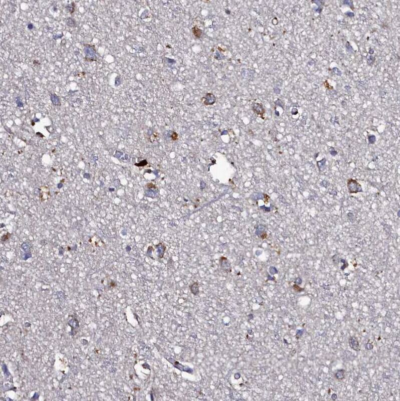 Thymidine Kinase 2 Antibody - BSA Free Immunohistochemistry-Paraffin: Thymidine Kinase 2 Antibody [NBP1-92505]