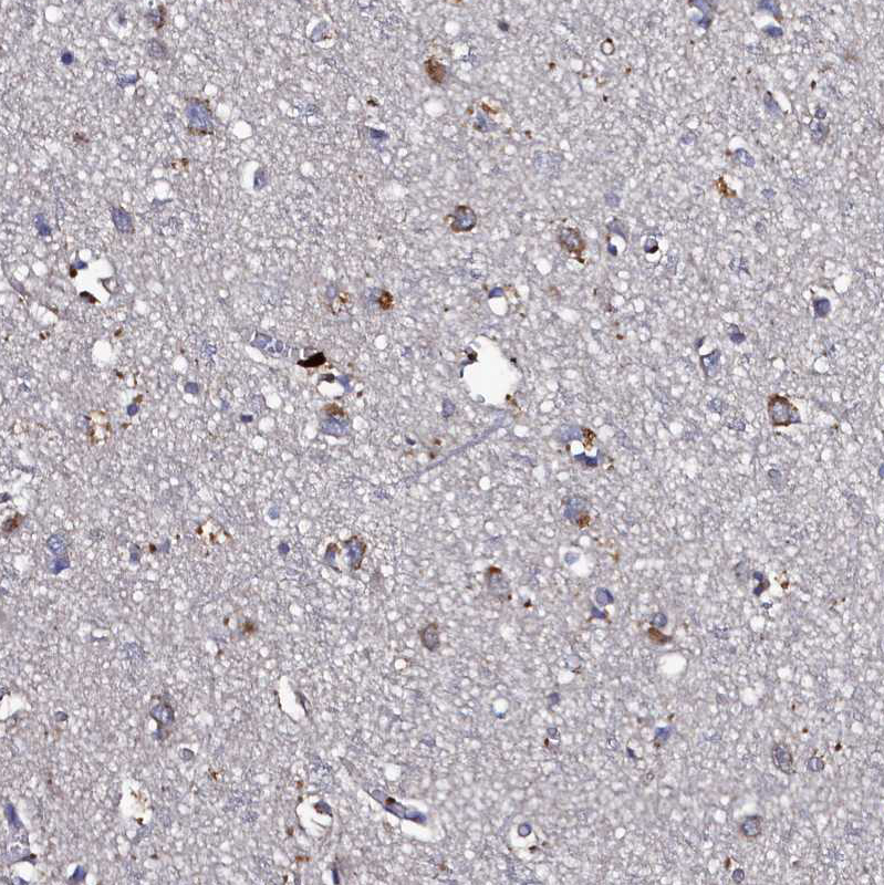 Thymidine Kinase 2 Antibody - BSA Free Immunohistochemistry: Thymidine Kinase 2 Antibody - BSA Free [NBP1-92505]