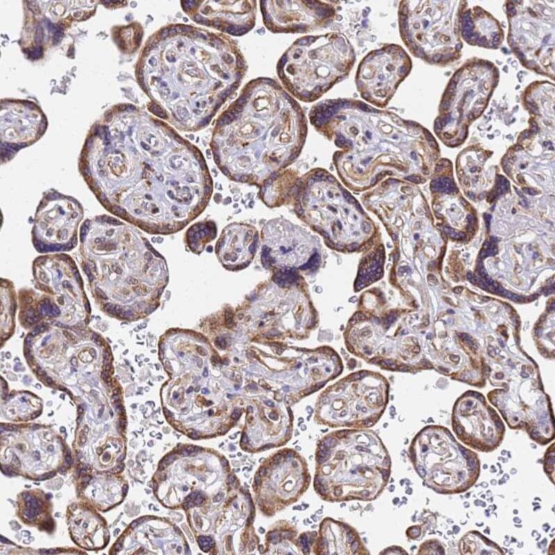 TMEM104 Antibody - BSA Free Immunohistochemistry: TMEM104 Antibody - BSA Free [NBP1-92515]