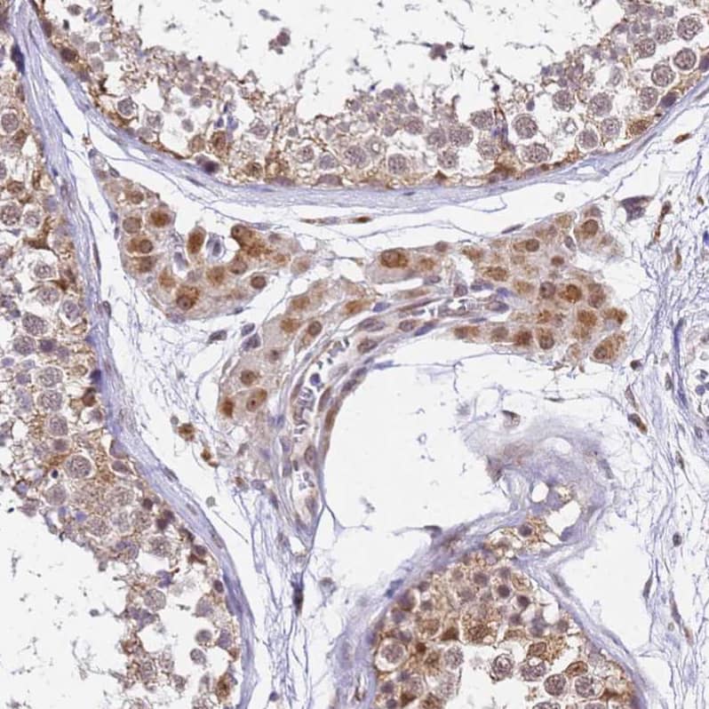 TMEM104 Antibody - BSA Free Immunohistochemistry: TMEM104 Antibody - BSA Free [NBP1-92515]