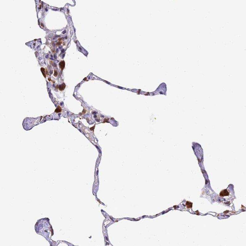 TMEM104 Antibody - BSA Free Immunohistochemistry: TMEM104 Antibody - BSA Free [NBP1-92515]
