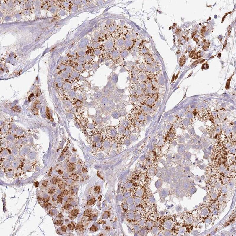 TMEM229B Antibody - BSA Free Immunohistochemistry: TMEM229B Antibody - BSA Free [NBP1-92520]