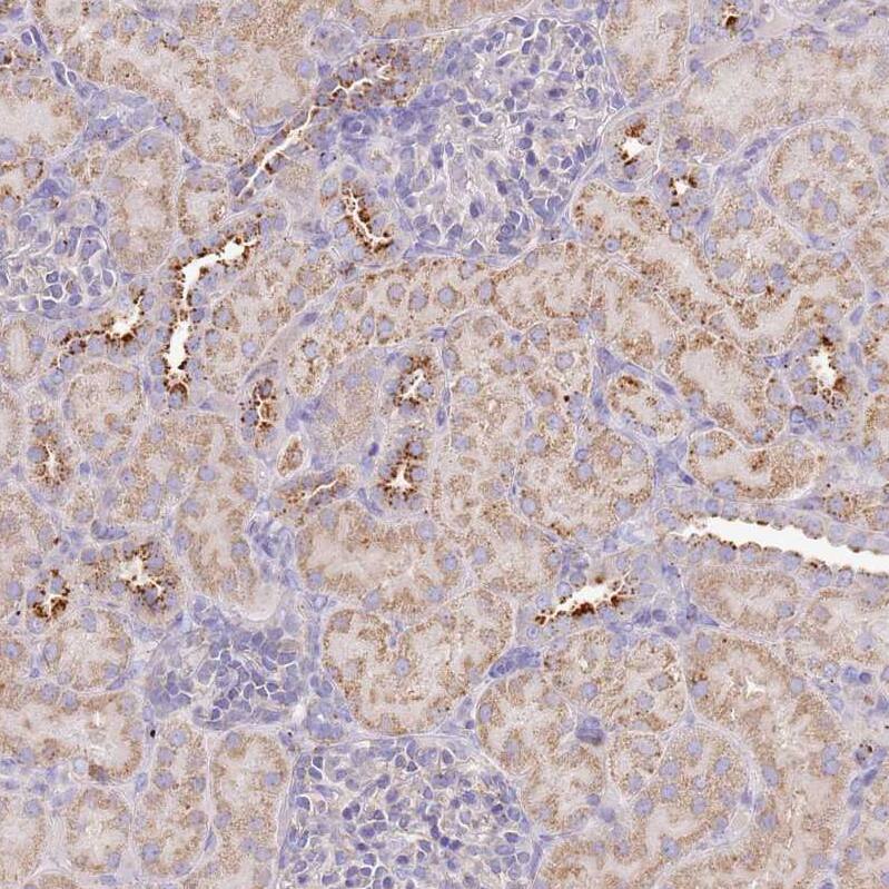 TMEM229B Antibody - BSA Free Immunohistochemistry: TMEM229B Antibody - BSA Free [NBP1-92520]