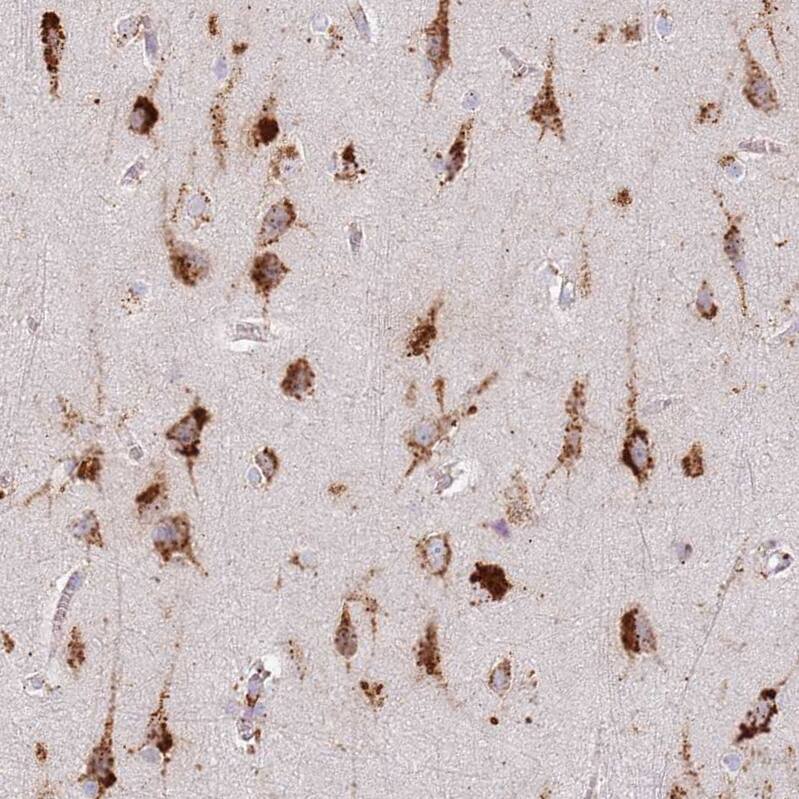 TMEM229B Antibody - BSA Free Immunohistochemistry: TMEM229B Antibody - BSA Free [NBP1-92520]