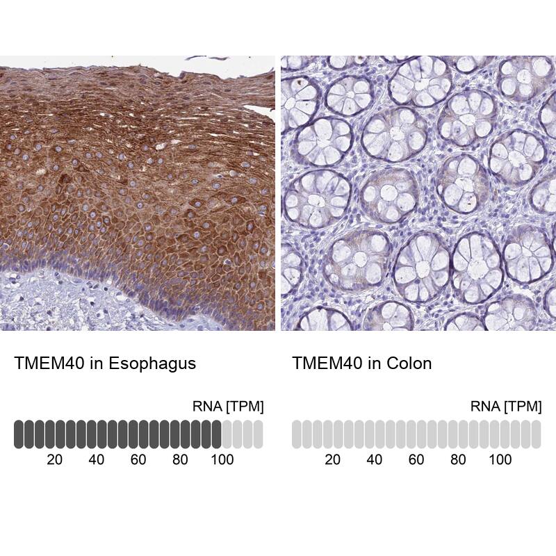 TMEM40 Antibody - BSA Free Immunohistochemistry: TMEM40 Antibody - BSA Free [NBP1-92521]