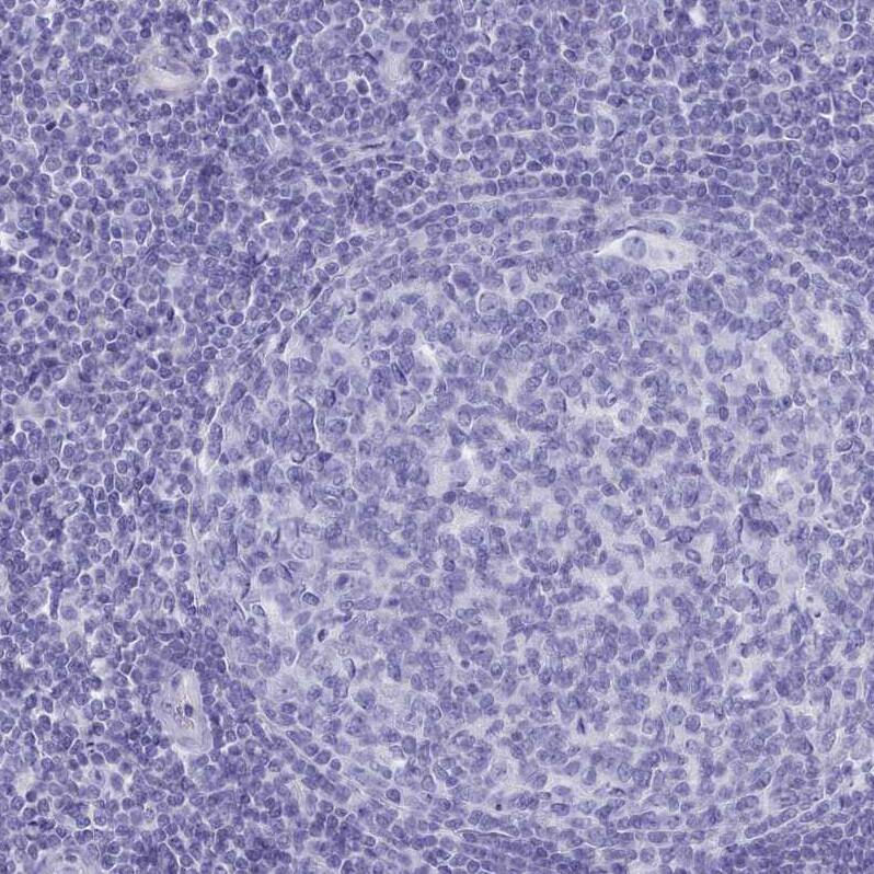 TMEM97 Antibody - BSA Free Immunohistochemistry: TMEM97 Antibody - BSA Free [NBP1-92522]