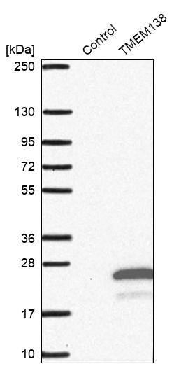 TMEM 138 Antibody - BSA Free Western Blot: TMEM 138 Antibody - BSA Free [NBP1-92528]