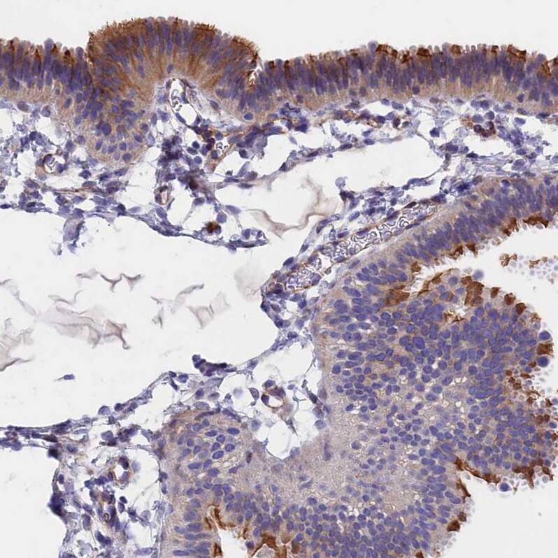 TMEM 138 Antibody - BSA Free Immunohistochemistry: TMEM 138 Antibody - BSA Free [NBP1-92528]