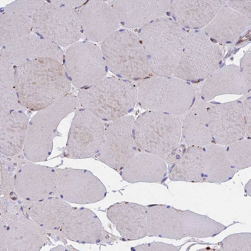 TMEM 138 Antibody - BSA Free Immunohistochemistry: TMEM 138 Antibody - BSA Free [NBP1-92528]