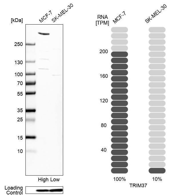 TRIM37 Antibody - BSA Free Western Blot: TRIM37 Antibody - BSA Free [NBP1-92529]