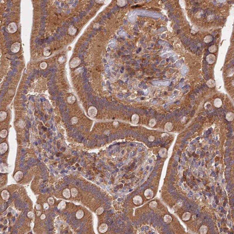 TRIM40 Antibody - BSA Free Immunohistochemistry: TRIM40 Antibody - BSA Free [NBP1-92530]