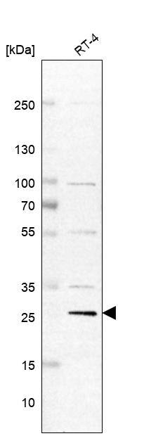 Troponin T Type 3 (fast skeletal) Antibody - BSA Free Western Blot: Troponin T Type 3 (fast skeletal) Antibody - BSA Free [NBP1-92534]